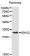 Zinc finger protein SNAI2 antibody, A01615-2, Boster Biological Technology, Western Blot image 