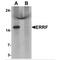 Steroid Receptor Associated And Regulated Protein antibody, MBS153353, MyBioSource, Western Blot image 