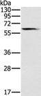 Solute Carrier Family 45 Member 3 antibody, PA5-50722, Invitrogen Antibodies, Western Blot image 