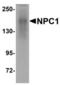 NPC Intracellular Cholesterol Transporter 1 antibody, TA306785, Origene, Western Blot image 