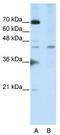 Surfeit 6 antibody, TA345983, Origene, Western Blot image 