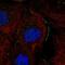 Acyl-CoA Thioesterase 13 antibody, NBP1-92498, Novus Biologicals, Immunofluorescence image 
