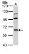 Mannosyl (Beta-1,4-)-Glycoprotein Beta-1,4-N-Acetylglucosaminyltransferase antibody, PA5-22212, Invitrogen Antibodies, Western Blot image 