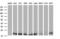 NME/NM23 Nucleoside Diphosphate Kinase 2 antibody, M01762, Boster Biological Technology, Western Blot image 