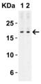 Interleukin 17A antibody, 4887, ProSci Inc, Western Blot image 
