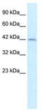 Paired Box 3 antibody, TA330544, Origene, Western Blot image 
