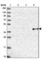 Solute Carrier Family 3 Member 1 antibody, NBP2-47272, Novus Biologicals, Western Blot image 