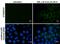 Carbonic Anhydrase 9 antibody, GTX629747, GeneTex, Immunocytochemistry image 