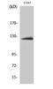 ATP Citrate Lyase antibody, STJ91780, St John