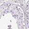Zymogen granule membrane protein 16 antibody, PA5-62629, Invitrogen Antibodies, Immunohistochemistry paraffin image 
