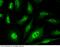Eukaryotic Translation Initiation Factor 4E Binding Protein 1 antibody, 10022-MM01T, Sino Biological, Immunohistochemistry paraffin image 