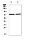 Early Growth Response 1 antibody, A00687-1, Boster Biological Technology, Western Blot image 