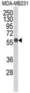 Aldehyde Dehydrogenase 3 Family Member B1 antibody, AP17880PU-N, Origene, Western Blot image 
