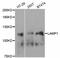 Lysosomal Associated Membrane Protein 1 antibody, A2582, ABclonal Technology, Western Blot image 