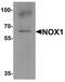 NADPH oxidase 1 antibody, PA5-38031, Invitrogen Antibodies, Western Blot image 
