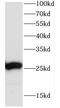 Coiled-Coil Domain Containing 85B antibody, FNab01370, FineTest, Western Blot image 