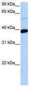 Zinc Finger Protein 562 antibody, TA339237, Origene, Western Blot image 