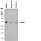 Acid Phosphatase 5, Tartrate Resistant antibody, AF3948, R&D Systems, Western Blot image 