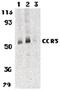 C-C Motif Chemokine Receptor 3 antibody, LS-C19439, Lifespan Biosciences, Western Blot image 