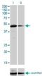 TATA-Box Binding Protein Associated Factor 7 antibody, H00006879-M01, Novus Biologicals, Western Blot image 