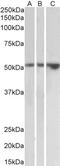 Vasodilator Stimulated Phosphoprotein antibody, 43-656, ProSci, Western Blot image 
