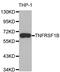 TNF Receptor Superfamily Member 1B antibody, A0387, ABclonal Technology, Western Blot image 