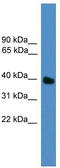 Ubiquitin Like Domain Containing CTD Phosphatase 1 antibody, TA340382, Origene, Western Blot image 