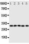 Aquaporin-9 antibody, GTX12315, GeneTex, Western Blot image 