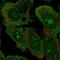 Dedicator Of Cytokinesis 4 antibody, NBP2-57555, Novus Biologicals, Immunocytochemistry image 