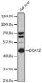 Diacylglycerol O-acyltransferase 2 antibody, GTX02814, GeneTex, Western Blot image 
