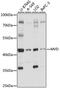 Mevalonate Diphosphate Decarboxylase antibody, 15-943, ProSci, Western Blot image 