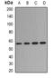Dihydropyrimidinase antibody, abx141845, Abbexa, Western Blot image 