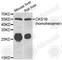 Cyclin-dependent kinases regulatory subunit 1 antibody, A6885, ABclonal Technology, Western Blot image 