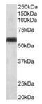 Cytochrome P450 Family 2 Subfamily C Member 8 antibody, orb125198, Biorbyt, Western Blot image 