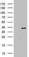 Histone Deacetylase 11 antibody, TA804542, Origene, Western Blot image 
