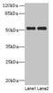 Phenylalanine Hydroxylase antibody, CSB-PA017396LA01HU, Cusabio, Western Blot image 