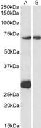 Sterol O-acyltransferase 1 antibody, orb20556, Biorbyt, Western Blot image 