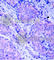 3-Phosphoinositide Dependent Protein Kinase 1 antibody, AP0426, ABclonal Technology, Immunohistochemistry paraffin image 