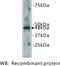 Cadherin EGF LAG seven-pass G-type receptor 2 antibody, MBS355067, MyBioSource, Western Blot image 