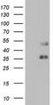FosB Proto-Oncogene, AP-1 Transcription Factor Subunit antibody, LS-C790198, Lifespan Biosciences, Western Blot image 