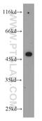 Growth Hormone Releasing Hormone Receptor antibody, 20715-1-AP, Proteintech Group, Western Blot image 