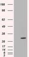 Cilia And Flagella Associated Protein 298 antibody, MA5-25158, Invitrogen Antibodies, Western Blot image 