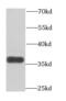 ADP-Ribosyltransferase 5 antibody, FNab00615, FineTest, Western Blot image 