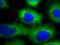DSP antibody, 25318-1-AP, Proteintech Group, Immunofluorescence image 