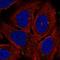 Adenylate Cyclase 7 antibody, HPA041218, Atlas Antibodies, Immunocytochemistry image 