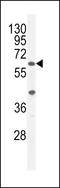 A1CF antibody, LS-C155929, Lifespan Biosciences, Western Blot image 