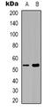 Septin 1 antibody, orb338918, Biorbyt, Western Blot image 