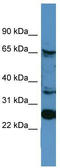 p90 antibody, TA342726, Origene, Western Blot image 