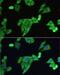 Solute carrier family 2, facilitated glucose transporter member 9 antibody, LS-C749605, Lifespan Biosciences, Immunofluorescence image 