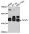 Glucosaminyl (N-Acetyl) Transferase 1 antibody, abx125871, Abbexa, Western Blot image 